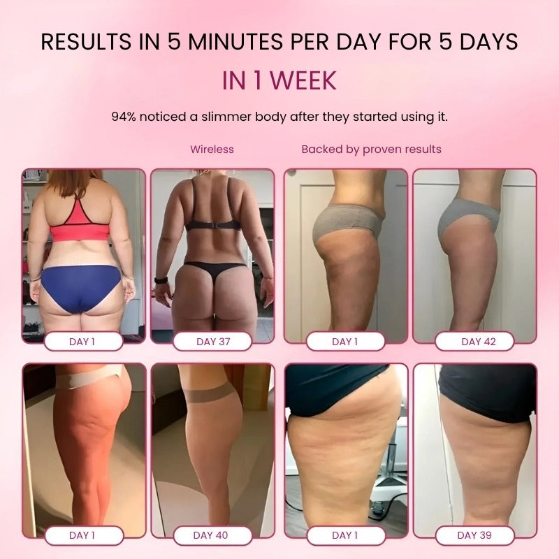 GlowCup – Cellulite and Skin Tightening with Red Light and Cupping